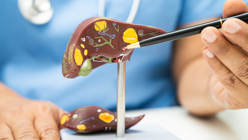 Fatty Liver in Young Indians: Causes, Cure & Diet