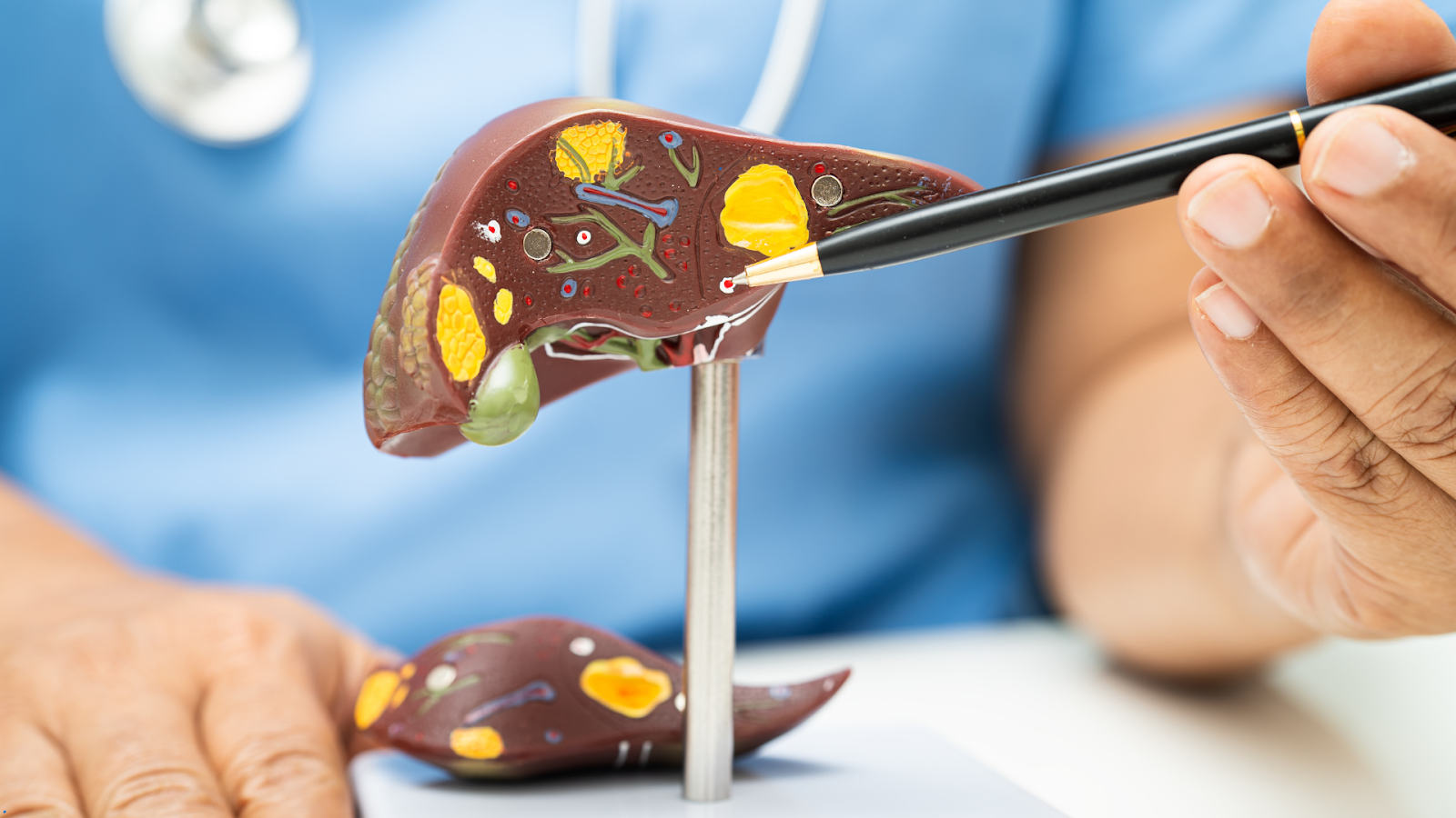 Fatty Liver in Young Indians: Causes, Cure & Diet