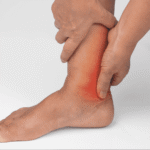 Why High Uric Acid is More Than Just "Gout" and Joint Pain