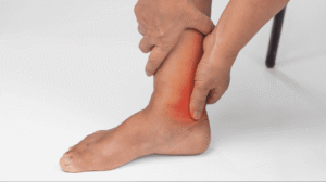 Why High Uric Acid is More Than Just "Gout" and Joint Pain